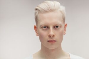 komplikasi albino