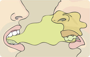 Penyebab bau Mulut