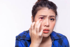 Risiko penggunaan softlens