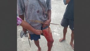 Warga Halmahera Tengah luka terpanah
