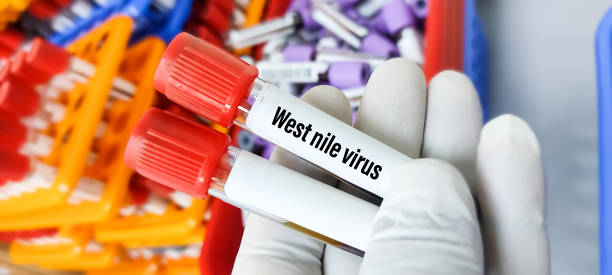 Virus West Nile