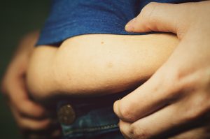 visceral fat