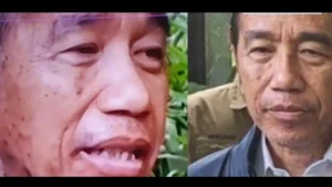 penyakit jokowi