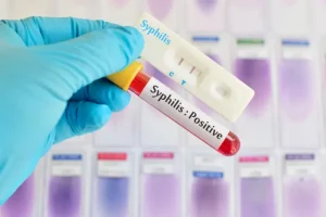 penyakit sifilis