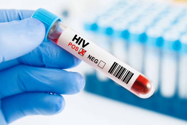HIV Subang