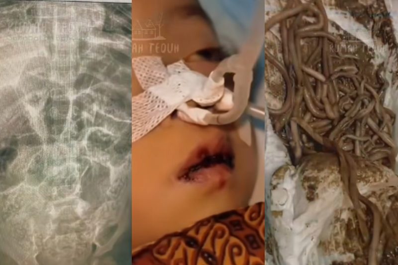 anak cacingan meninggal di sukabumi-1