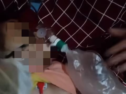 Balita di Bengkulu mengeluarkan Cacing