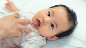 Tongue Tie pada Bayi